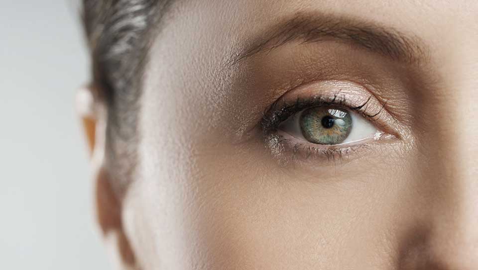 Dermal-fillers-after-image