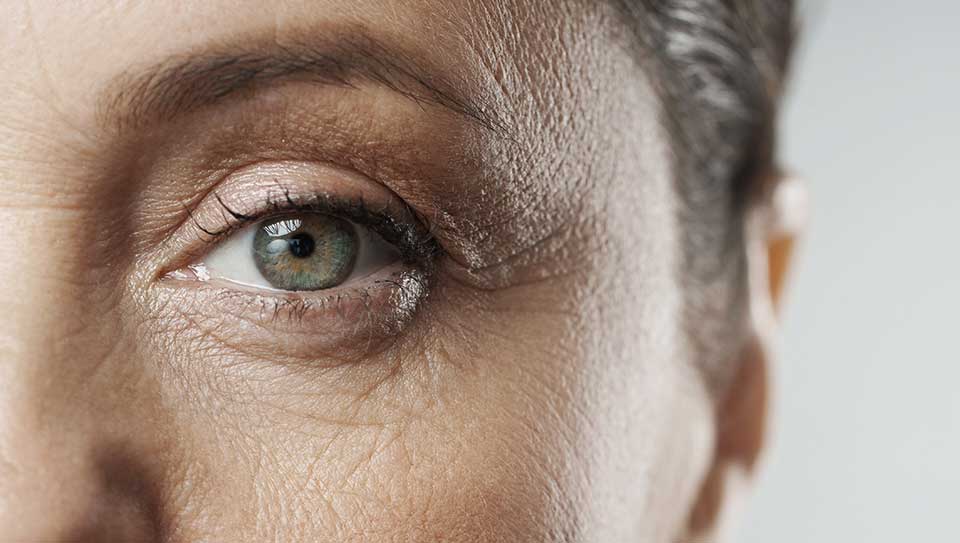 Dermal-fillers-before-image