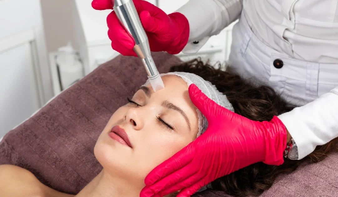 Women Receiving Microneedling in Baldwinsville, NY
