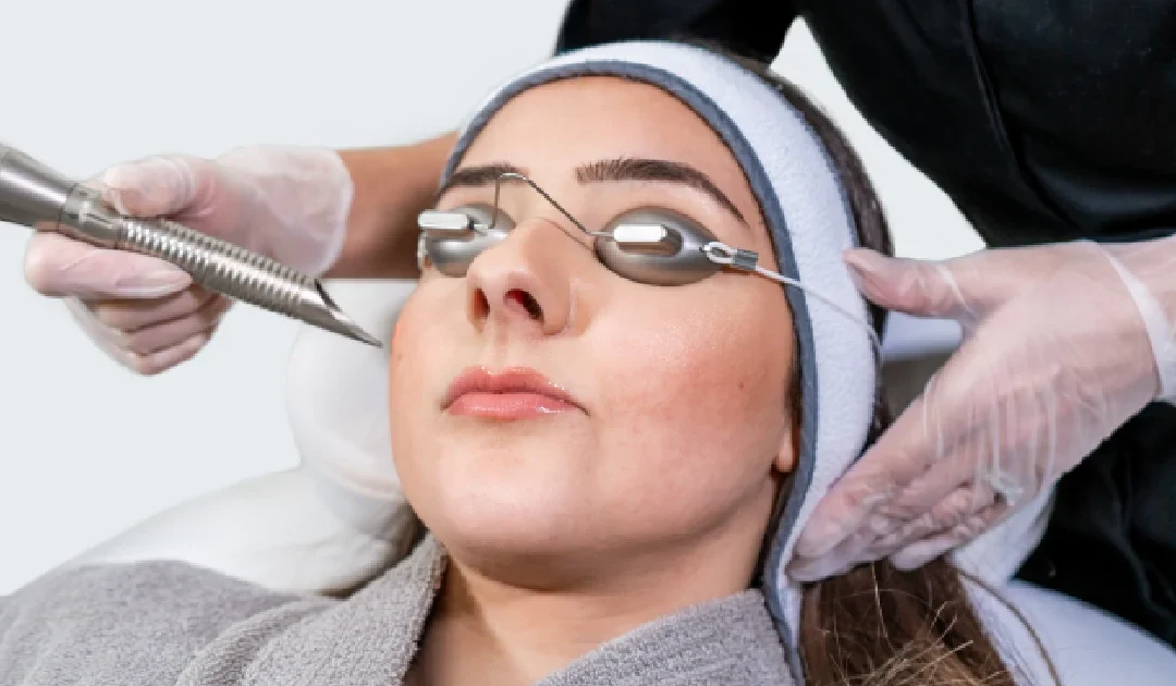 woman undergoing an Erbium laser skin resurfacing treatment in Baldwinsville, NY