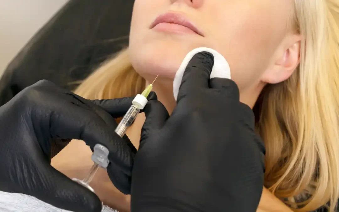 Dermal Filler for Your Face and Goals